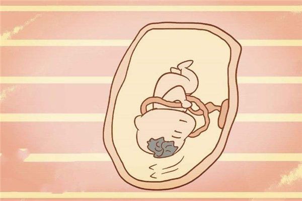 孕婦夢見寶寶臍帶繞頸_周公解夢 孕婦夢見寶寶臍帶繞頸是什麼意思_孕婦夢見寶寶臍帶繞頸好不好_周公解夢官網
