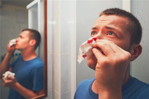 夢到自己流很多鼻血是好是壞_周公解夢