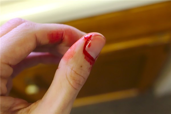 夢到滿手是血是什麼意思_周公解夢