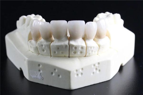 夢見掉上牙是什麼意思_周公解夢