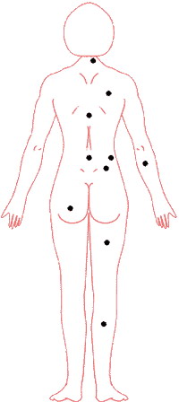 Position and fate of nevus figure: 02, mole good or ill luck quick points required gist _ visit fortune-teller daqo moles