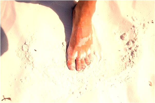 夢到了正在地里挖紅薯什麼預兆_周公解夢官網