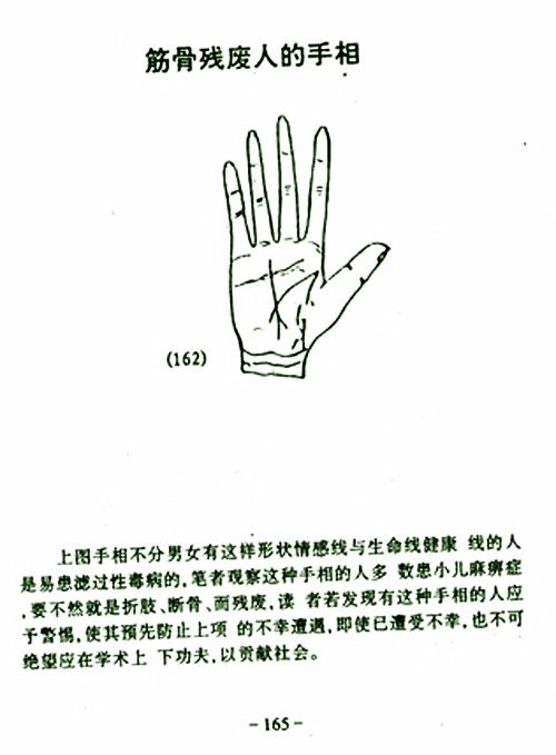 The physique of the disabled palms