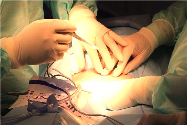 夢到了自己抓到一條鯉魚預示著什麼_周公解夢官網