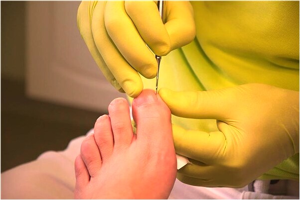 夢見羽毛球拍頭掉了什麼寓意_周公解夢官網