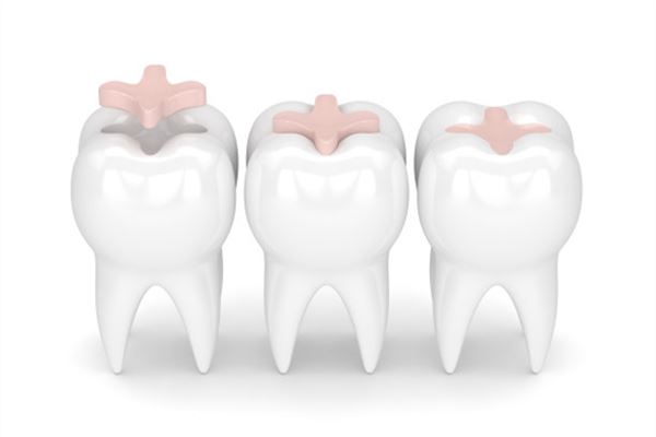 夢見修牙是什麼意思_周公解夢
