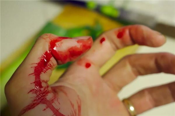 夢見出血_周公解夢