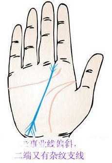 Business line has two, another line end with spherical portend?