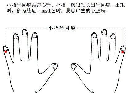 Half moon marks view health diagram 5