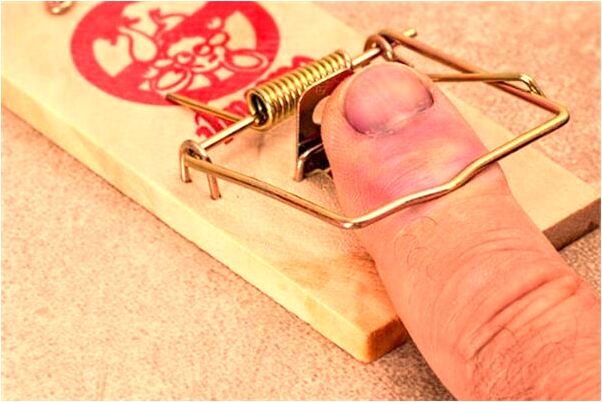 夢見汽車自己撞壞有什麼預兆_周公解夢官網