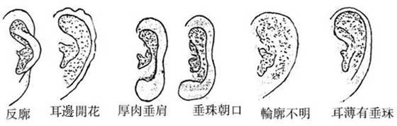 Yi faces fortune-telling illustration: ear shape