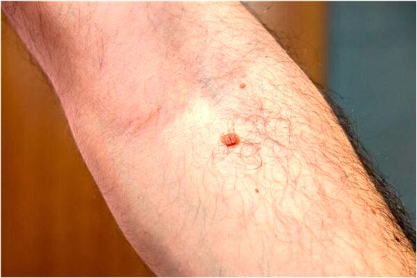 夢見看見小孩身上有傷會是什麼預兆_周公解夢官網