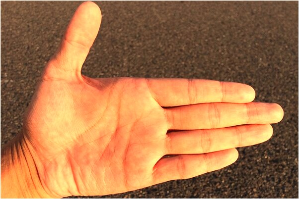 夢到被蛇咬到處求醫是什麼意思？_周公解夢官網