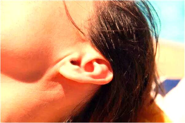 夢到狐狸對我笑怎么回事_周公解夢官網