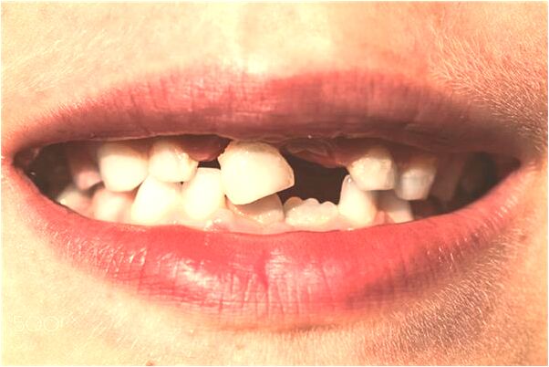 夢到摘石榴沒摘下來有什麼預兆_周公解夢官網