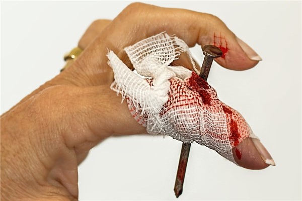 夢到傷口出血怎麼樣_周公解夢