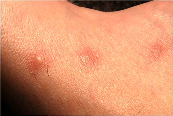 夢到了有誤會的朋友從背後抱著我有什麼意義嗎_周公解夢官網