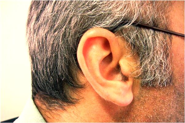 夢見許多斷腿的蟾蜍怎么回事_周公解夢官網