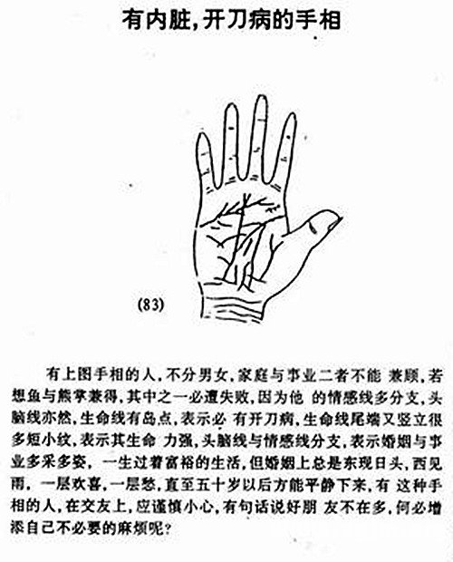 Have guts, invasive disease palm diagram