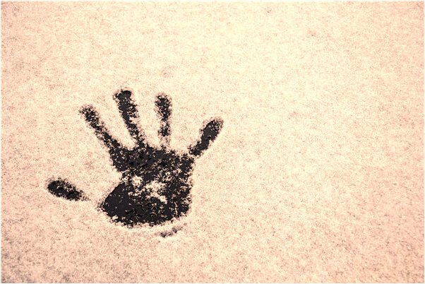 夢到腿被刀個割流血代表著什麼_周公解夢官網