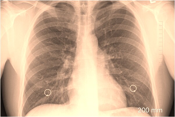 夢到被母親養的毒蛇咬到會有什麼預兆_周公解夢官網