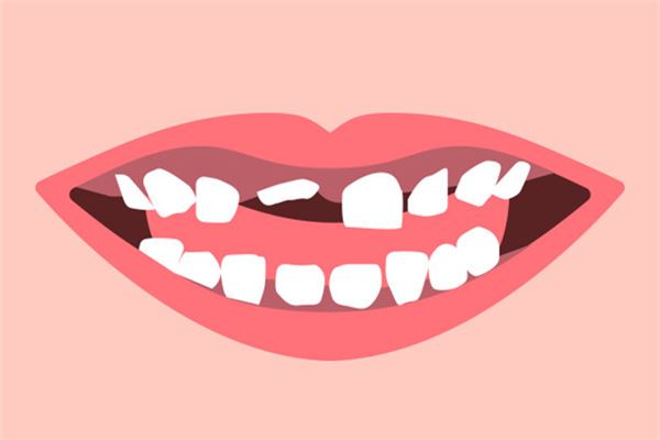 夢見牙齒掉了一顆_周公解夢