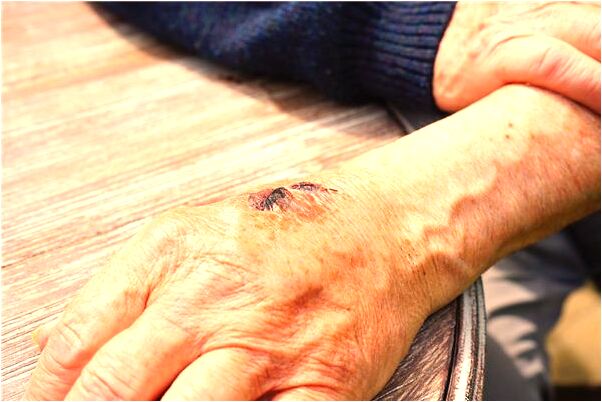 夢到了兩條蛇攻擊有什麼意義嗎_周公解夢官網