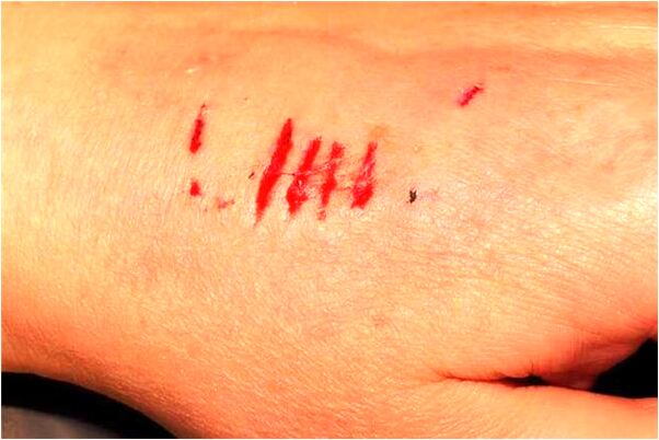 夢到爺爺要殺了我是凶兆還是吉兆_周公解夢官網