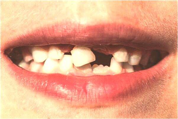 夢到了追同學地面下陷他不等我是什麼意思_周公解夢官網