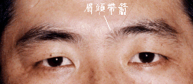 Physiognomy analysis: 6, stop ─ in the eye and eyebrow _ to visit fortune-teller accomplishment