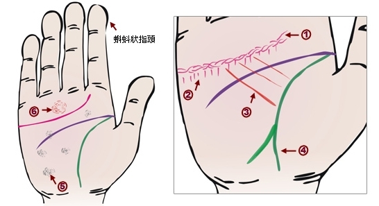 手相看病