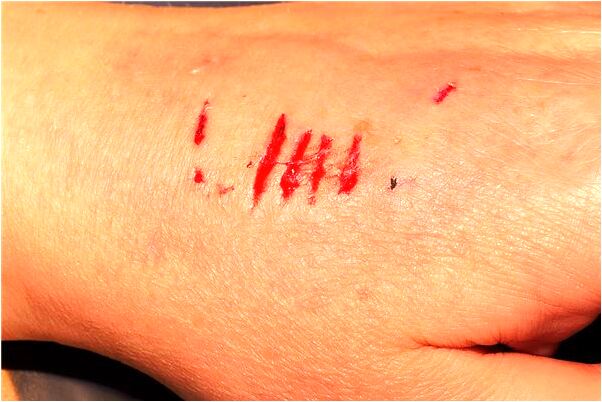 夢到幫我爸擋刀是好是壞_周公解夢官網