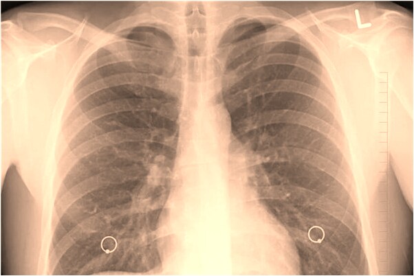 夢見揀兩百塊錢有什麼含義_周公解夢官網