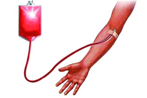 Dream of blood transfusion