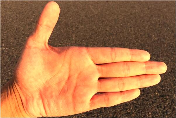 夢見父親的手留血是怎麼回事_周公解夢官網