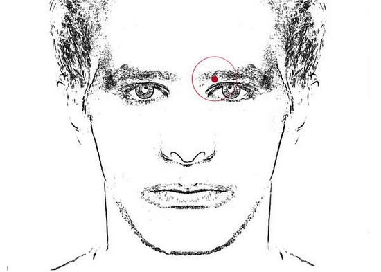 The position of graphic facial 30 mole and fate