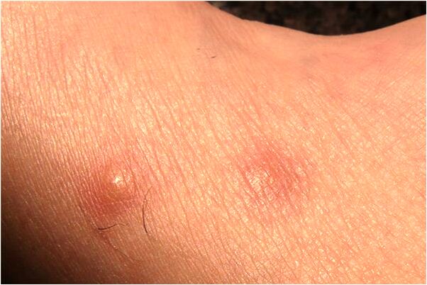 夢到了臨盆的親戚生了女孩啥意思_周公解夢官網