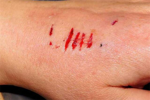 夢到了狗咬流血有什麼徵兆_周公解夢