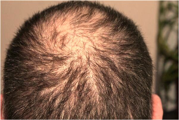 夢到媽媽碰破頭流血意味著什麼_周公解夢官網