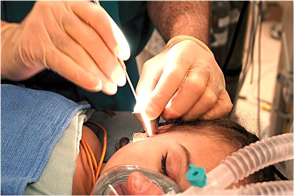 夢到下牙被拔掉預示什麼_周公解夢官網