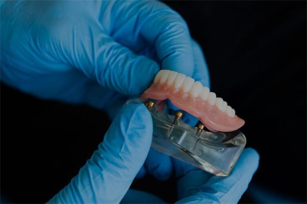 夢到假牙掉什麼預兆_周公解夢