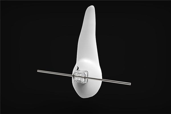 夢到了父親掉牙好不好_周公解夢