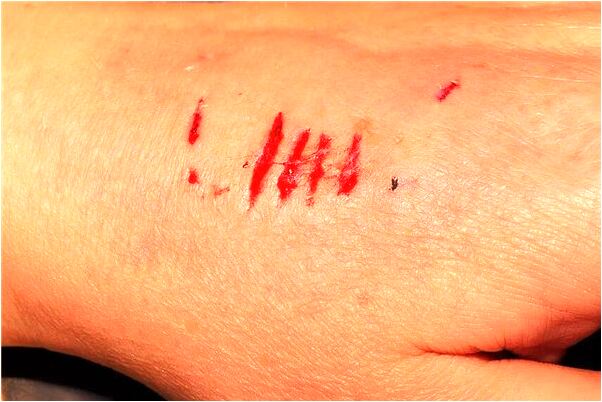 夢見老公開車失靈撞人流血代表著什麼_周公解夢官網