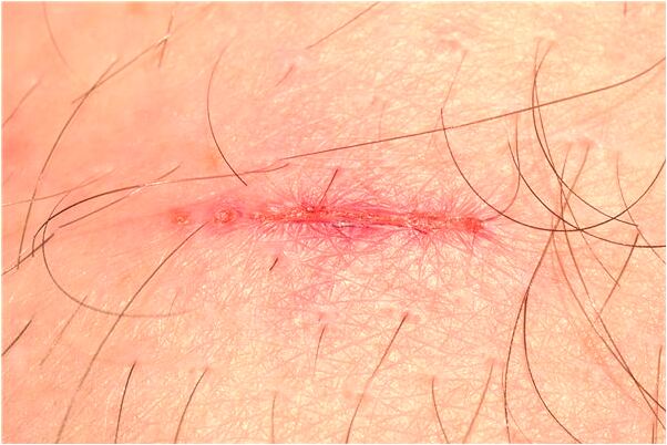 夢到了臭水溝里釣魚有什麼徵兆_周公解夢官網