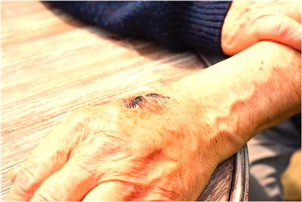 夢見虎牙自己給搬下來是什麼徵兆_周公解夢官網