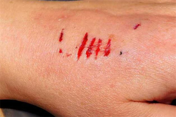 夢到了被狗咬手出血是什麼預兆？_周公解夢