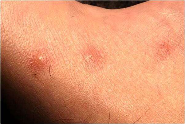 夢見做愛被兄弟打擾了代表什麼_周公解夢官網