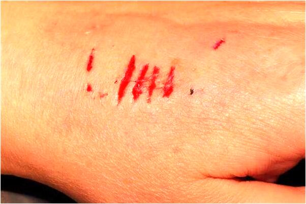 夢到了牙齒張沖會是什麼預兆_周公解夢官網