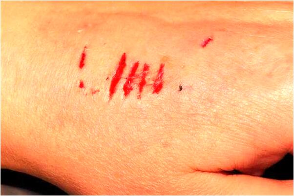 夢到被魚咬到腳出血好不好_周公解夢官網