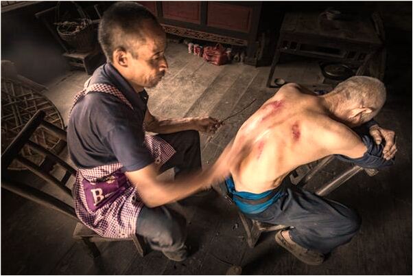 夢到爸爸得皮膚病意味著有什麼意思嗎_周公解夢官網